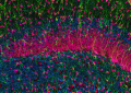 Hippocampus. Thomas Deerinck and Mark Ellisman (2004). Photomicrograph of different types of cellular structures in the rat hippocampus, a brain area implicated in learning and memory. This sample was prepared by performing an antibody staining, which exploits the extraordinary ability of natural antibodies to recognize specific molecules.