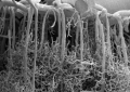 Cortical blood vessels. Alfonso Rodríguez-Baeza and Marisa Ortega-Sánchez (2009). Photomicrograph of the microscopic blood vessels that shuttle oxygen and nutrients to neurons in the brain, obtained with a scanning electron microscope. This sample, from Human cerebral cortex, shows a large blood vessel at the surface of the brain (top), which sends down thin, densely branched capillaries to deliver blood throughout the entire cortex.